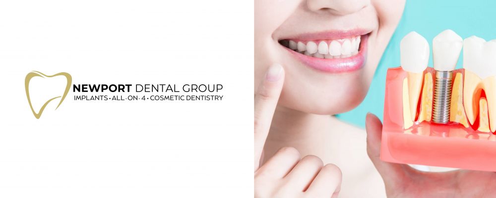 Newport Dental Group Cover Image