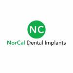 NorCal Dental Implants